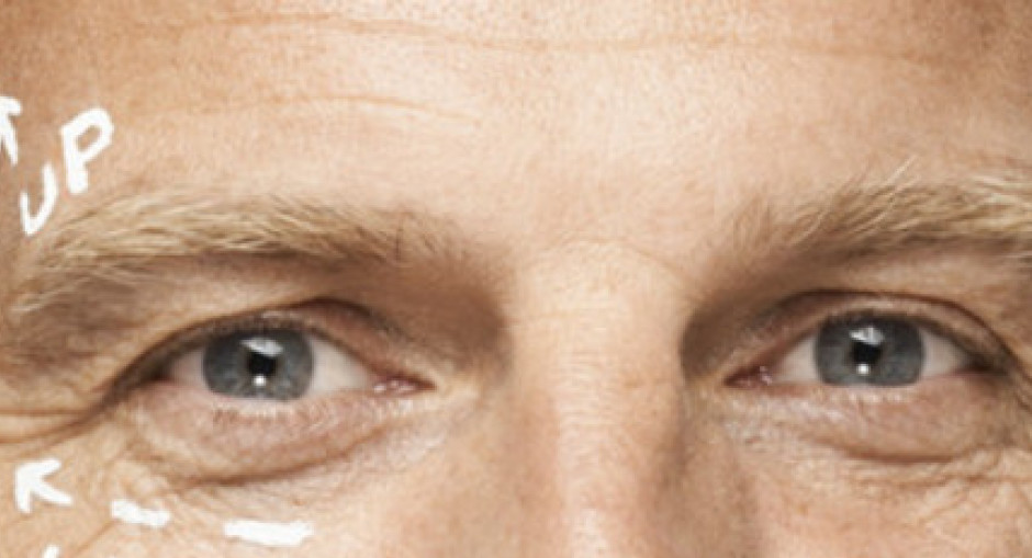 Botox for Facial Wrinkles